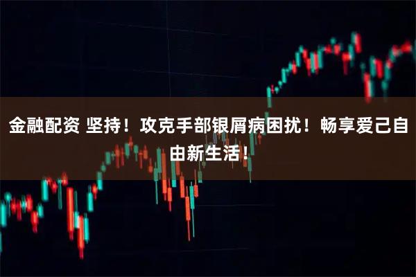 金融配资 坚持！攻克手部银屑病困扰！畅享爱己自由新生活！